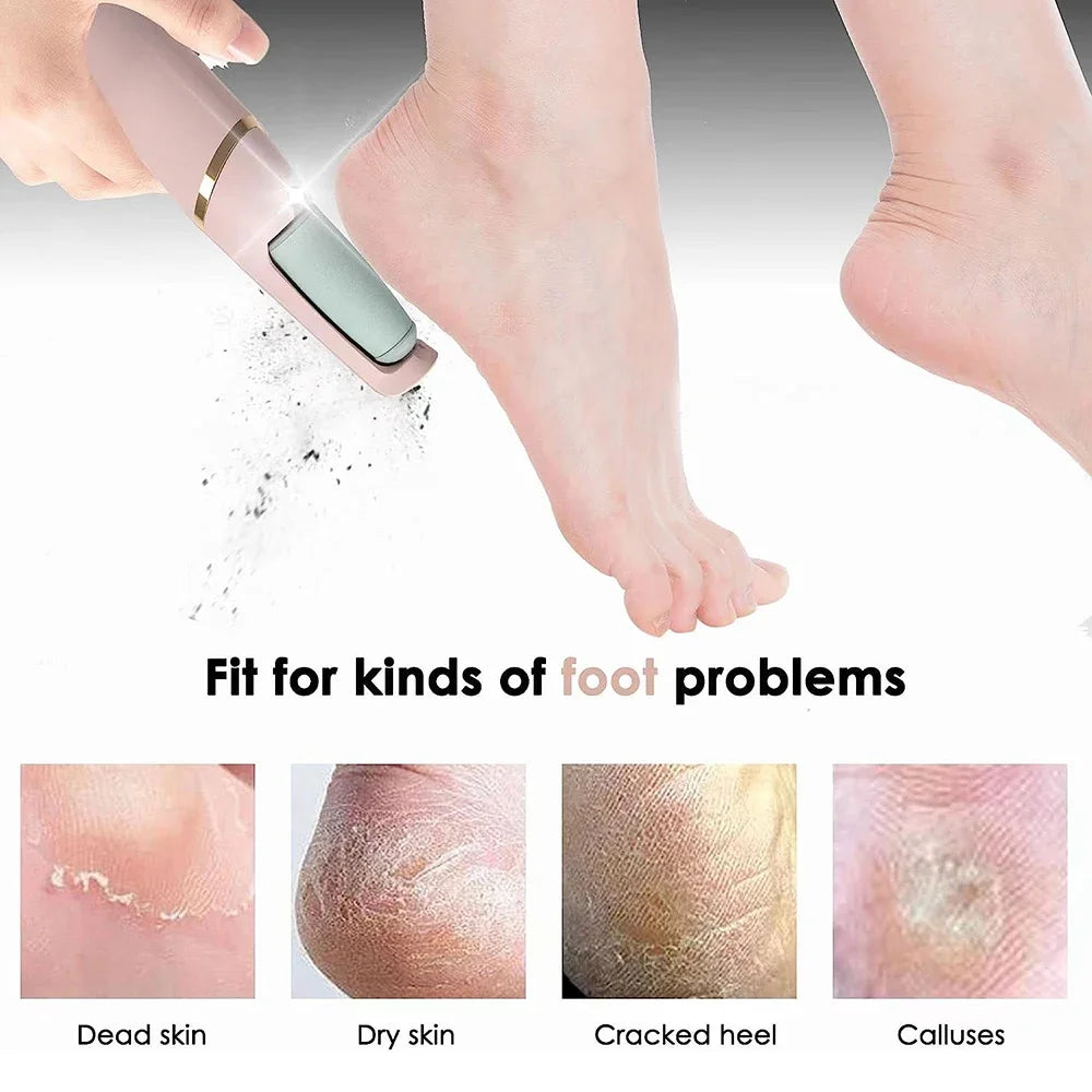 Electric Skin Dead Cell Remover