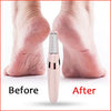 Electric Skin Dead Cell Remover